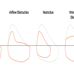 Read more about the article Interpreting Abnormal Lung Function Results: What Do They Mean?