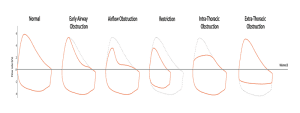 Read more about the article Interpreting Abnormal Lung Function Results: What Do They Mean?