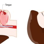 Read more about the article Sleep Apnea and Its Effect on Lung Function