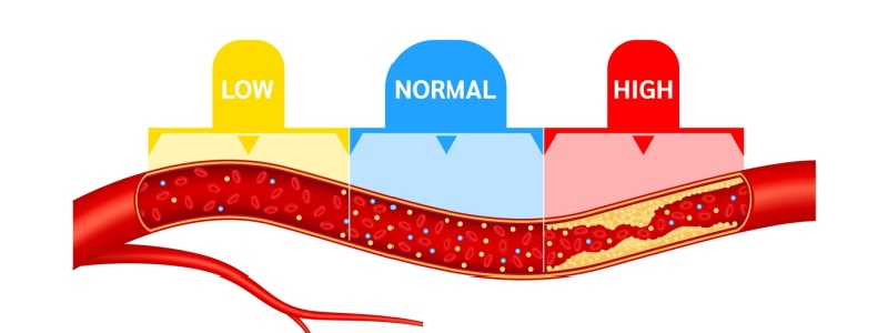 You are currently viewing High Cholesterol and Heart Disease: Understanding the Connection