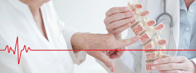 You are currently viewing Understanding Osteoporosis: How Occupational Health Services Can Help